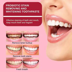 LOVILDS™ Probiotic Whitening Toothpaste