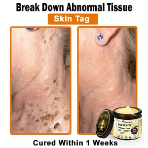 Ourlyard® Botulinum Toxin & Bee Venom Skin Treatment Cream