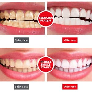 LOVILDS™ Probiotic Whitening Toothpaste