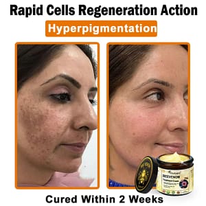 Ourlyard® Botulinum Toxin & Bee Venom Skin Treatment Cream