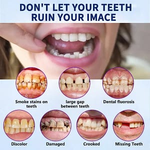 HZA™-Advanced Customized Full Denture Set