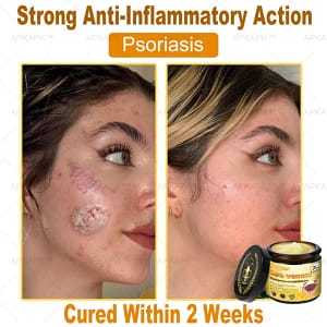 APKAPK™ Bee Venom Skin Treatment Cream