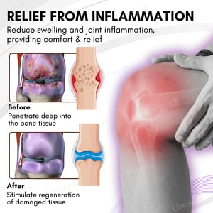 Cvreoz® Turmeric & Emu Oil Arthritis Soothing Pain Relief Massage Gel
