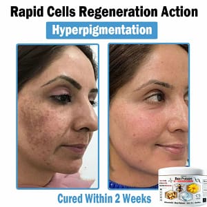 LOVILDS™ Bee poison Multi-Symptom Skin Treatment Cream