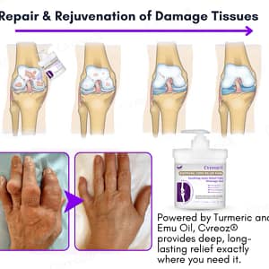 Cvreoz® Turmeric & Emu Oil Arthritis Soothing Pain Relief Massage Gel