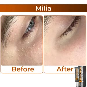 LOVILDS™ Collagen Wake Up Eye Cream