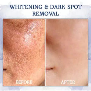 LOVILDS™ Advanced Firming & Wrinkle-Reducing Cream