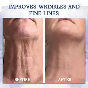 LOVILDS™ Advanced Firming & Wrinkle-Reducing Cream