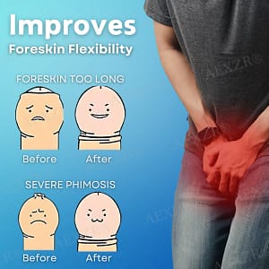 AEXZR® Glans and Foreskin Care Cream