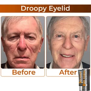 LOVILDS™ Collagen Wake Up Eye Cream