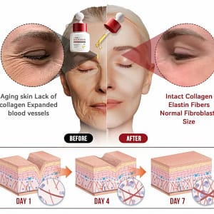 LOVILDS™ Toxin Bee Poison Anti-Aging Wrinkle Serum