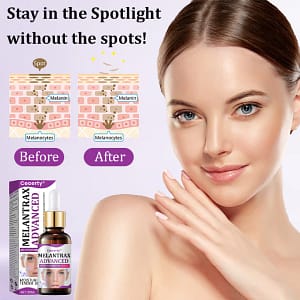 Ceoerty® MelantraX Advanced Anti-Hyperpigmentation Essence