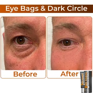 LOVILDS™ Collagen Wake Up Eye Cream