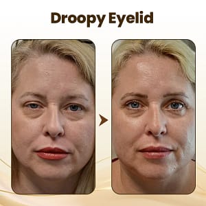 LOVILDS™ Collagen Wake Up Eye Cream