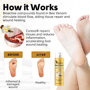 Cvreoz® Bee Venom Diabetic Foot Treatment Spray