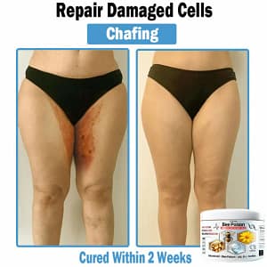 LOVILDS™ Bee poison Multi-Symptom Skin Treatment Cream
