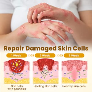 LOVILDS™ BeeDerma Repair Cream (USA)