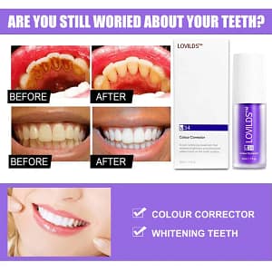 LOVILDS™ Bright Smile Saver Mousse Toothpaste