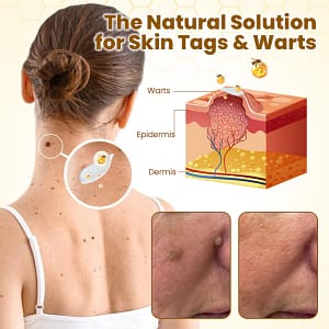 LOVILDS™ BeeDerma Repair Cream (USA)