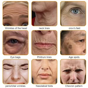 APKAPK™ Bee Venom Skin Treatment Cream