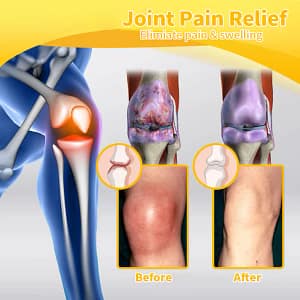 LOVILDSTM Bee Poison Advanced Joint and Bone Therapy Cream