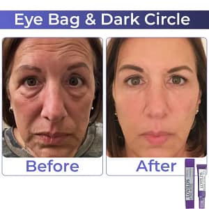 LOVILDS Retinol Intense Advanced Triple Action Eye Cream