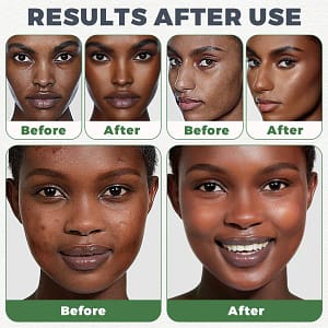 Lovilds™ Natural Black Soap – The Ultimate Solution for Skin Health & Healing