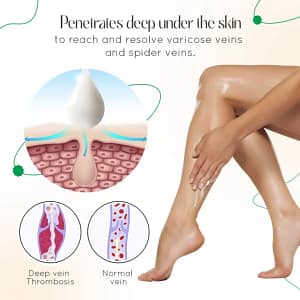 LOVILDS™ Vein Therapy Cream