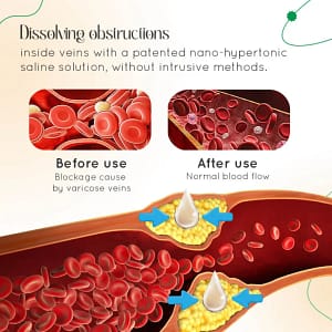 LOVILDS™ Vein Therapy Cream