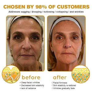 Kisshi™ Botox Bee Venom Wrinkle Removal Cream