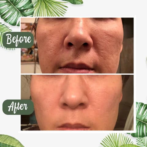 LOVILDS™ Purifying and Antibacterial Green Tea Mask
