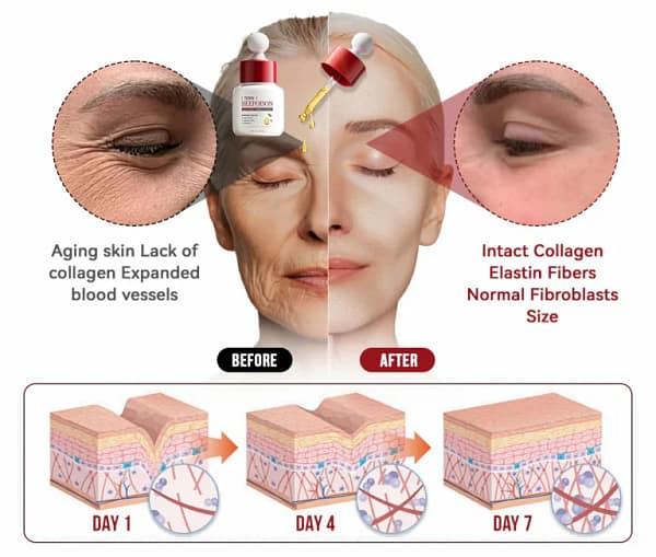 LOVILDS™ Toxin Bee Poison Anti-Aging Wrinkle Serum