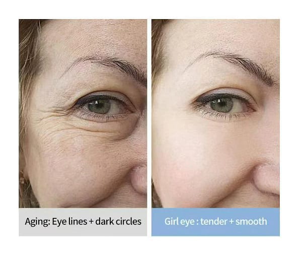 Lovilds™ Electric Anti Wrinkle Eye Cream