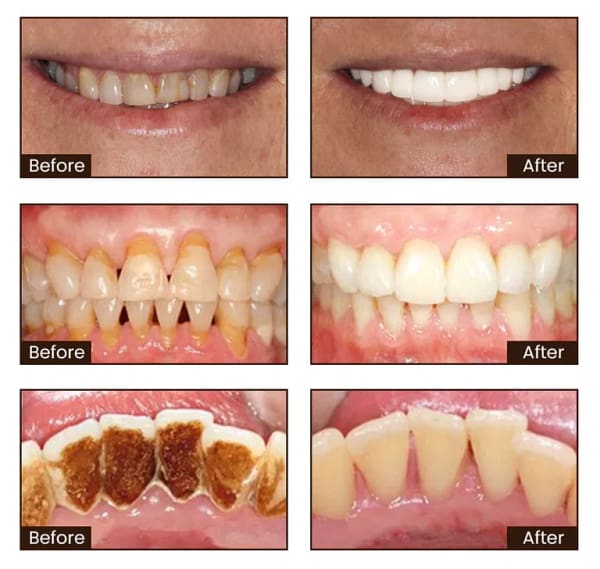 LOVILDS SP-8 Whitening Toothpaste