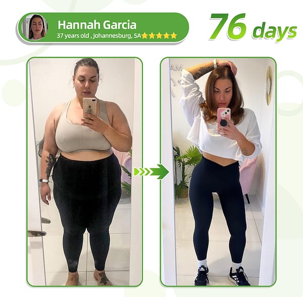SMGT-GLP-1 & Matrixyl 3000 – Slimming, Skin