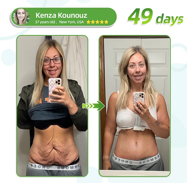 SMGT-GLP-1 & Matrixyl 3000 – Slimming, Skin