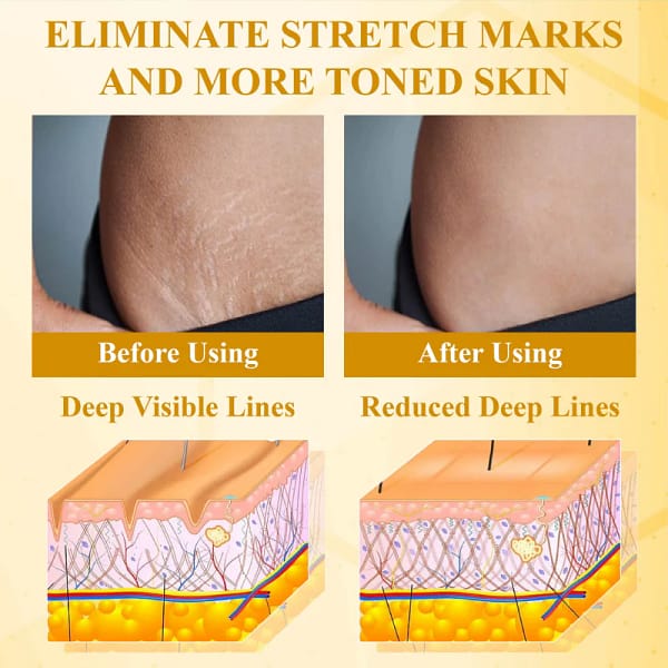 LOVILDS™ BotoxBee Advanced Multi Action Firming Cream