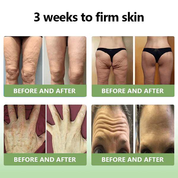LOVILDS™ Luxurious Collagen Firming Cream
