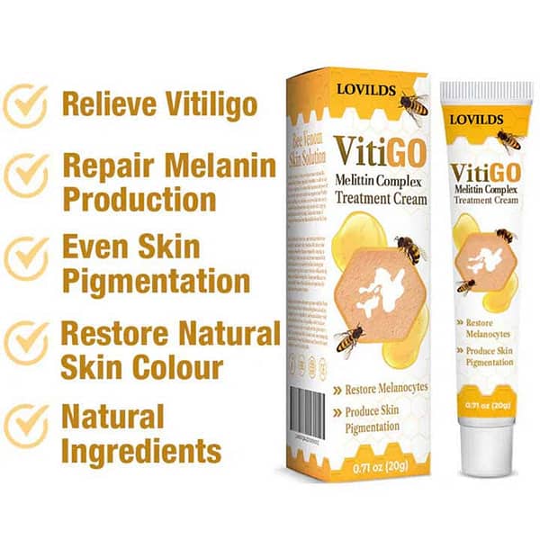 LOVILDS™ Melittin Complex Vitiligo Treatment Cream