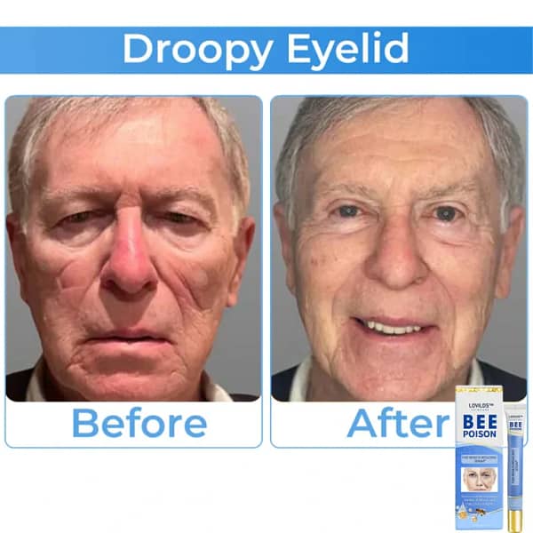 LOVILDS™ Collagen+ Bee Poison Wake Up Eye Cream