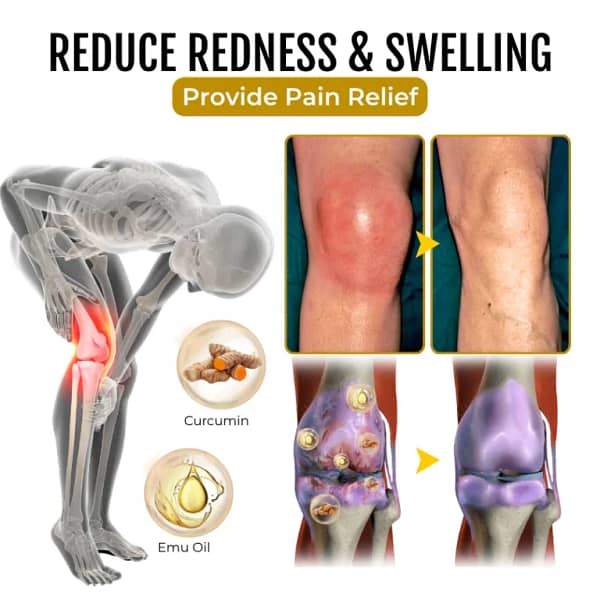 LOVILDS™ArthroSoothe Turmeric & Emu Oil Pain Relief Massage Gel