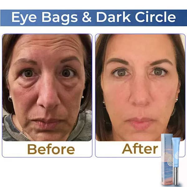 Lovilds™ Electric Anti Wrinkle Eye Cream
