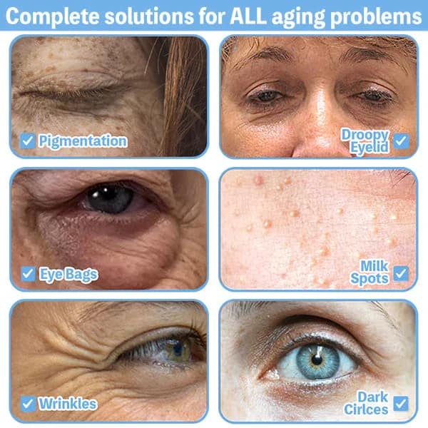 LOVILDS™ Collagen+ Bee Poison Wake Up Eye Cream