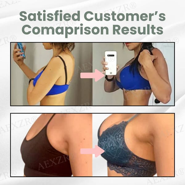 AEXZR® Microneedle Breast Plump Set