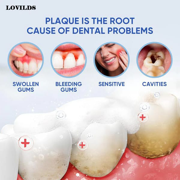 LOVILDS™Probiotic Whitening Toothpaste