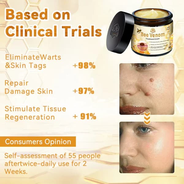 Turonu™ Bee Venom Treatment Cream