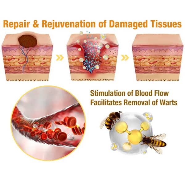 LOVILDS™ TagRecede Bee Venom Treatment Cream