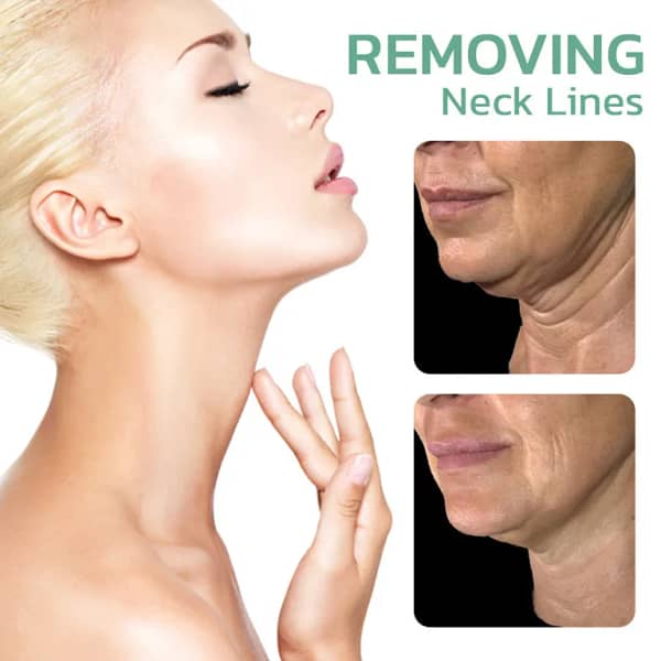 LOVILDS™ CollagenPlus Matrixyl Synthe’6 Lifting Body Oil