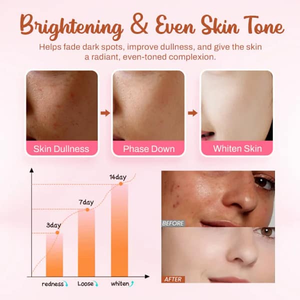 LOVILDS™ Whitening and Freckle – Removing Mask
