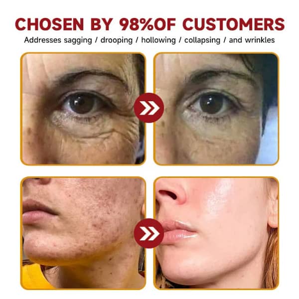LOVILDS™ Toxin Bee Poison Anti-Aging Wrinkle Serum